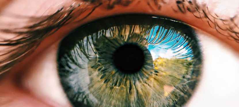 What is the Difference Between Conjunctivochalasis and Dry&nbsp;Eyes?