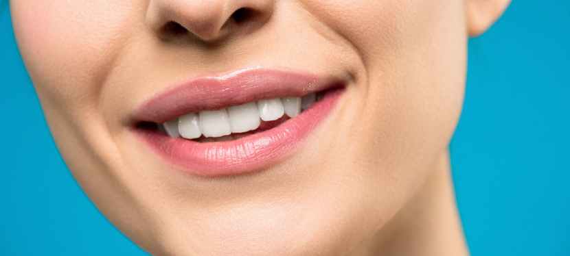 Dental Bonding: 5 Key Takeaways